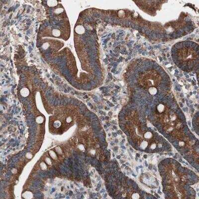 Immunohistochemistry-Paraffin CTTNBP2NL Antibody