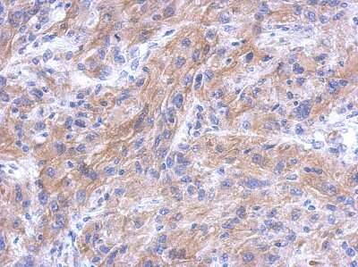 Immunohistochemistry-Paraffin: CTTNBP2NL Antibody [NBP2-16032] - Immunohistochemical analysis of paraffin-embedded U373 xenograft, using antibody at 1:500 dilution.