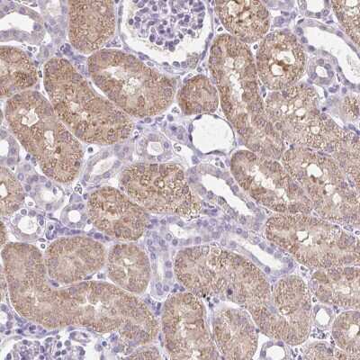 Immunohistochemistry: CTU1 Antibody [NBP2-47500] - Staining of human kidney shows moderate cytoplasmic positivity in cells in tubules.