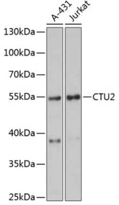Western Blot: CTU2 Antibody [NBP2-92099] - Analysis of extracts of various cell lines, using CTU2 at 1:3000 dilution.Secondary antibody: HRP Goat Anti-Rabbit IgG (H+L) at 1:10000 dilution.Lysates/proteins: 25ug per lane.Blocking buffer: 3% nonfat dry milk in TBST.Detection: ECL Basic Kit .Exposure time: 90s.