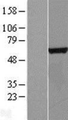 Western Blot CTU2 Overexpression Lysate