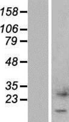 Western Blot: CTXN1 Overexpression Lysate (Adult Normal) [NBP2-04540] Left-Empty vector transfected control cell lysate (HEK293 cell lysate); Right -Over-expression Lysate for CTXN1.