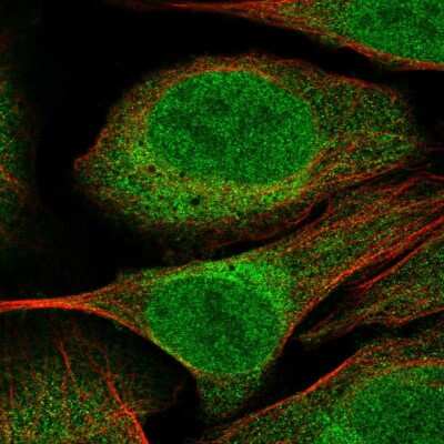 Immunocytochemistry/Immunofluorescence: CUEDC2 Antibody [NBP2-58980] - Staining of human cell line U-2 OS shows localization to nucleoplasm & cytosol.
