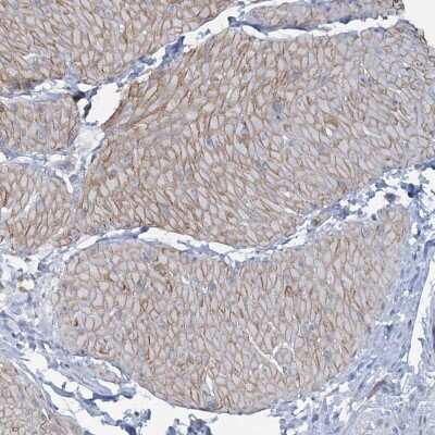 Immunohistochemistry-Paraffin: CUEDC2 Antibody [NBP1-88538] - Staining of human smooth muscle shows moderate cytoplasmic positivity in smooth muscle cells.