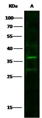 Western Blot: CUEDC2 Antibody [NBP2-99801] - Anti-CUEDC2 rabbit polyclonal antibody at 1:500 dilution. Lane A: Hela Whole Cell Lysate. Lysates/proteins at 30 ug per lane. Secondary Goat Anti-Rabbit IgG H&L (Dylight 800) at 1/10000 dilution. Developed using the Odyssey technique. Performed under reducing conditions. Predicted band size: 32 kDa. Observed band size: 36 kDa (We are unsure as to the identity of these extra bands).