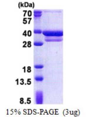 SDS-Page: CUEDC2 Protein [NBP2-22968]