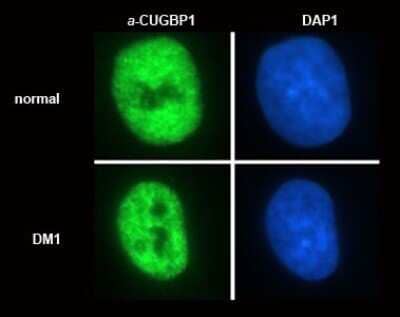 Immunocytochemistry/Immunofluorescence: CUGBP1/CELF1 Antibody (3B1) - Azide and BSA Free [NBP2-80684] - Detection of the subcellular distribution of CUGBP1 (nuclear, non-nucleolar) in normal and DM1 (dystrophia myotonica) myoblasts. Image from the standard format of this antibody.