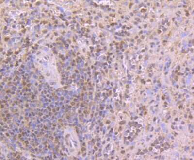 Immunohistochemistry-Paraffin: CUGBP1/CELF1 Antibody (7A1) [NBP2-75457] - Analysis of paraffin-embedded human spleen tissue using anti-CELF1 antibody. Counter stained with hematoxylin.
