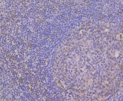 Immunohistochemistry-Paraffin: CUGBP1/CELF1 Antibody (7A1) [NBP2-75457] - Analysis of paraffin-embedded human tonsil tissue using anti-CELF1 antibody. Counter stained with hematoxylin.