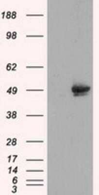 Western Blot: CUGBP1/CELF1 Antibody (OTI5B8) - Azide and BSA Free [NBP2-71623] - HEK293T cells were transfected with the pCMV6-ENTRY control (Left lane) or pCMV6-ENTRY CUGBP1 (Right lane) cDNA for 48 hrs and lysed. Equivalent amounts of cell lysates (5 ug per lane) were separated by SDS-PAGE and immunoblotted with anti-CUGBP1.