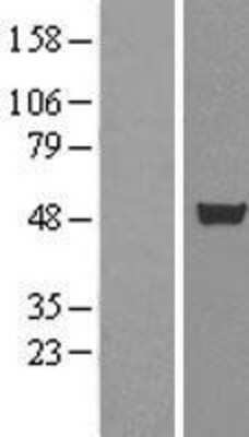 Western Blot: CUGBP1 Overexpression Lysate (Adult Normal) [NBL1-09604] Left-Empty vector transfected control cell lysate (HEK293 cell lysate); Right -Over-expression Lysate for CUGBP1.