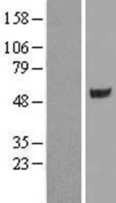 Western Blot: CUGBP1 Overexpression Lysate (Adult Normal) [NBL1-09605] Left-Empty vector transfected control cell lysate (HEK293 cell lysate); Right -Over-expression Lysate for CUGBP1.