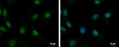 Immunocytochemistry/Immunofluorescence: CUGBP2 Antibody [NBP2-16034] - CUGBP2 antibody detects CUGBP2 protein at nucleus by immunofluorescent analysis. Sample: U87-MG cells were fixed in 4% paraformaldehyde at RT for 15 min. Green: CUGBP2 protein stained by CUGBP2 antibody diluted at 1:500. Blue: Hoechst 33342 staining. Scale bar = 10 um.