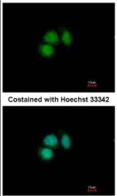 Immunocytochemistry/Immunofluorescence: CUGBP2 Antibody [NBP2-16035] - Analysis of paraformaldehyde-fixed MCF-7, using antibody at 1:500 dilution.