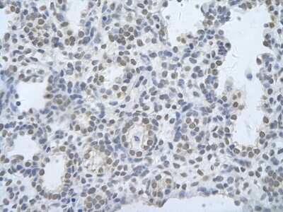 Immunohistochemistry: CUGBP2 Antibody [NBP1-57376] - Paraffin Embedded Tissue: Human alveolar cell Cellular Data: Epithelial cells of renal tubule Antibody Concentration: 4.0 - 8.0 ug/ml Magnification: 400X