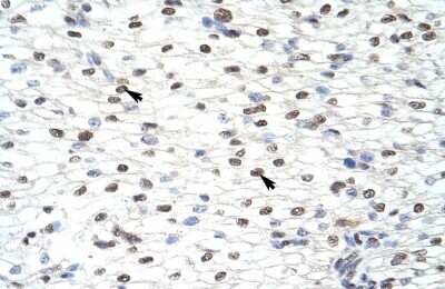 Immunohistochemistry: CUGBP2 Antibody [NBP1-57376] - Paraffin Embedded Tissue: Human Heart Cellular Data: Myocardial cells Antibody Concentration: 4.0 - 8.0 ug/ml Magnification: 400X