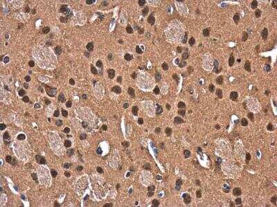 Immunohistochemistry-Paraffin: CUGBP2 Antibody [NBP2-16034] - CUGBP2 antibody detects CUGBP2 protein at cytoplasm and nucleus in mouse brain by immunohistochemical analysis. Sample: Paraffin-embedded mouse brain. CUGBP2 antibody diluted at 1:500.