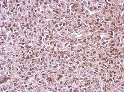 Immunohistochemistry-Paraffin: CUGBP2 Antibody [NBP2-16035] - Immunohistochemical analysis of paraffin-embedded RT2 xenograft, using antibody at 1:500 dilution.