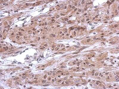 Immunohistochemistry-Paraffin: CUGBP2 Antibody [NBP2-16035] - Immunohistochemical analysis of paraffin-embedded U373 xenograft, using antibody at 1:500 dilution.