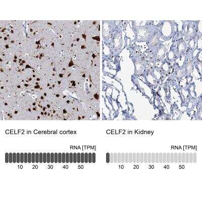 Immunohistochemistry-Paraffin: CUGBP2 Antibody [NBP2-48646] - Immunohistochemistry analysis in human cerebral cortex and kidney tissues. Corresponding RNA-seq data are presented for the same tissues.