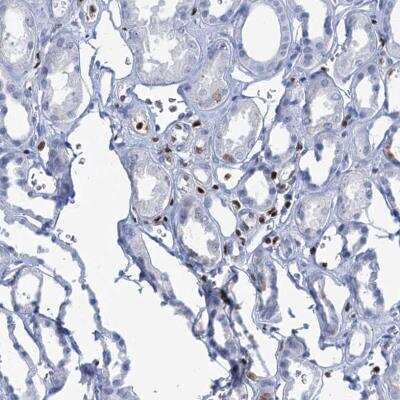 Immunohistochemistry-Paraffin: CUGBP2 Antibody [NBP2-48646] - Staining of human kidney shows no nuclear positivity in cells in tubules.