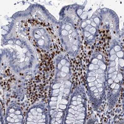 Immunohistochemistry-Paraffin: CUGBP2 Antibody [NBP2-48646] - Staining of human colon shows strong nuclear positivity in lymphoid cells.