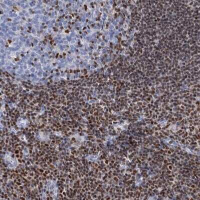 Immunohistochemistry-Paraffin: CUGBP2 Antibody [NBP2-48646] - Staining of human tonsil shows moderate to strong nuclear positivity in non-germinal center cells.