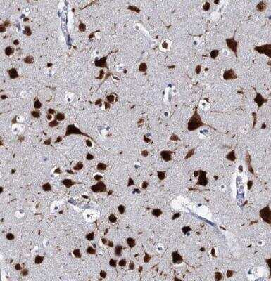 <b>Orthogonal Strategies Validation. </b>Immunohistochemistry-Paraffin: CUGBP2 Antibody [NBP2-48646] - Staining of human cerebral cortex shows moderate to strong cytoplasmic positivity in neurons.