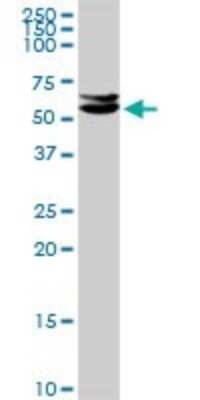 Western Blot: CUGBP2 Antibody [H00010659-D01P] - Analysis of CUGBP2 expression in mouse lung.