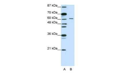 Western Blot: CUGBP2 Antibody [NBP1-57376] - Reccomended Titration: 1.25 ug/ml ELISA Titer: 1:312500 Positive Control: Jurkat cell lysate CELF2 is strongly supported by BioGPS gene expression data to be expressed in Human Jurkat cells