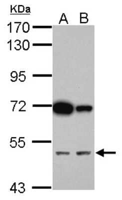 Western Blot: CUGBP2 Antibody [NBP2-16034] - Sample (30 ug of whole cell lysate) A: PC-3 B: U87-MG 7. 5% SDS PAGE gel, diluted at 1:1000.