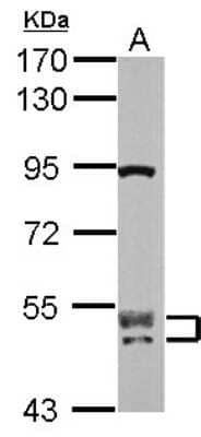 Western Blot CUGBP2 Antibody