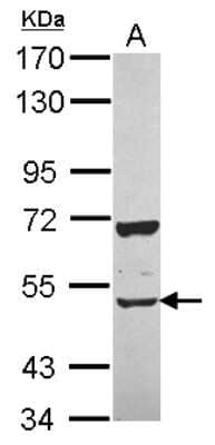 Western Blot CUGBP2 Antibody