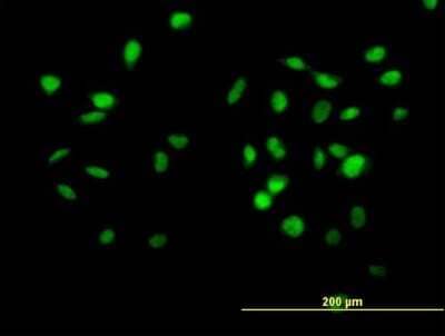 Immunocytochemistry/Immunofluorescence: CUL4B Antibody [H00008450-B01P] - Analysis of purified antibody to CUL4B on HeLa cell. (antibody concentration 10 ug/ml)