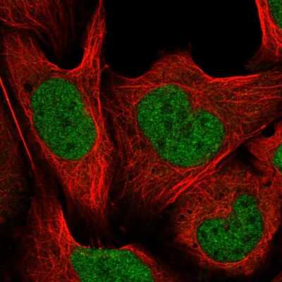 Immunocytochemistry/Immunofluorescence: CUL4B Antibody [NBP2-56697] - Staining of human cell line U-2 OS shows localization to nucleoplasm.