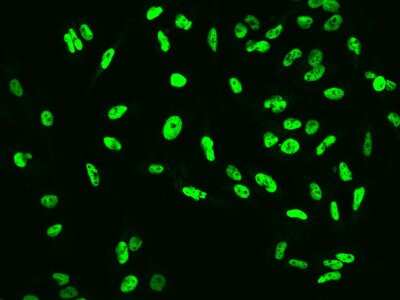 Immunocytochemistry/Immunofluorescence: CUL4B Antibody [NBP2-97399] - Immunofluorescence staining of CUL4B in U251MG cells. Cells were fixed with 4% PFA, permeabilzed with 0.1% Triton X-100 in PBS, blocked with 10% serum, and incubated with rabbit anti-Human CUL4B polyclonal antibody (dilution ratio 1:200) at 4C overnight. Then cells were stained with the Alexa Fluor(R)488-conjugated Goat Anti-rabbit IgG Secondary antibody (green). Positive staining was localized to Nucleus.