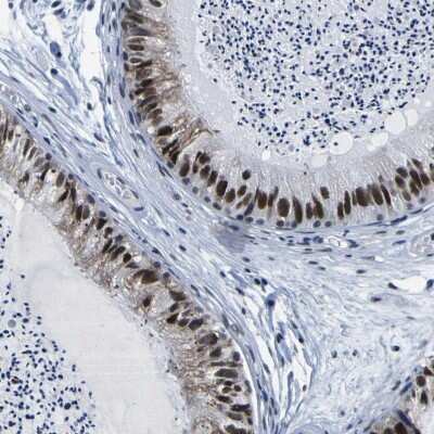 Immunohistochemistry-Paraffin CUL4B Antibody