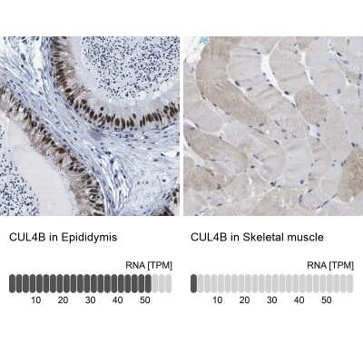 Immunohistochemistry-Paraffin CUL4B Antibody