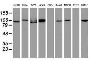 Western Blot: CUL4B Antibody (OTI1C4) - Azide and BSA Free [NBP2-71373] - Analysis of extracts (35ug) from 9 different cell lines by using CUL4B monoclonal antibody (HepG2: human; HeLa: human; SVT2: mouse; A549: human; COS7: monkey; Jurkat: human; MDCK: canine; PC12: rat; MCF7: human).