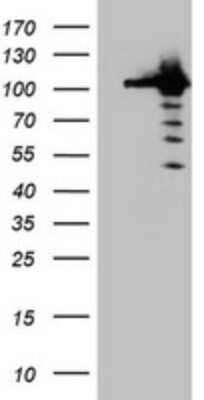 Western Blot: CUL4B Antibody (OTI1C4) - Azide and BSA Free [NBP2-71373] - Analysis of HEK293T cells were transfected with the pCMV6-ENTRY control (Left lane) or pCMV6-ENTRY CUL4B.