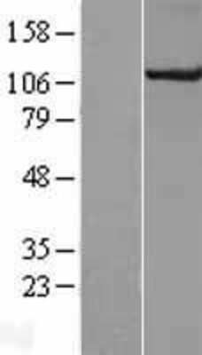 Western Blot: CUL4B Overexpression Lysate (Adult Normal) [NBL1-09610] Left-Empty vector transfected control cell lysate (HEK293 cell lysate); Right -Over-expression Lysate for CUL4B.