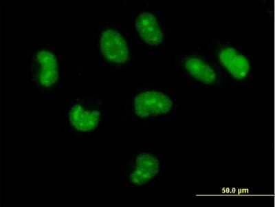 Immunocytochemistry/Immunofluorescence: CUTC Antibody [H00051076-B01P] - Analysis of purified antibody to CUTC on HeLa cell. (antibody concentration 10 ug/ml)