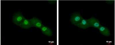 Immunocytochemistry/Immunofluorescence: CUTC Antibody [NBP2-16038] - H1299 cells were fixed in 4% paraformaldehyde at RT for 15 min. Green: CUTC protein stained by CUTC antibody [N1C2]  diluted at 1:500. Blue: Hoechst 33342 staining. Scale bar = 10 um