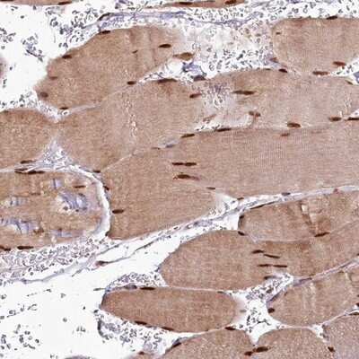 Immunohistochemistry-Paraffin CUTC Antibody - BSA Free