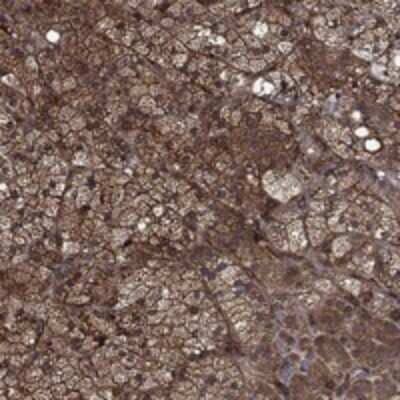 Immunohistochemistry-Paraffin: CUTC Antibody [NBP3-17827] - Staining of human adrenal gland shows strong cytoplasmic positivity in glandular cells.