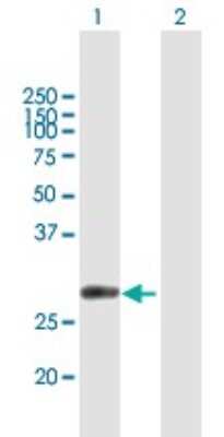 Western Blot: CUTC Antibody [H00051076-B01P] - Analysis of CUTC expression in transfected 293T cell line by CUTC polyclonal antibody.  Lane 1: CUTC transfected lysate(30.03 KDa). Lane 2: Non-transfected lysate.