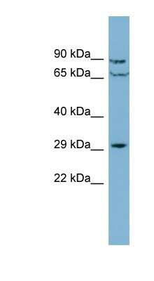 Western Blot: CUTC Antibody [NBP1-56858] - Jurkat cell lysate, concentration 0.2-1 ug/ml.