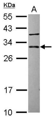 Western Blot CUTC Antibody - BSA Free