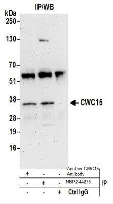 Immunoprecipitation: CWC15 Antibody [NBP2-44275] - Western Blot of Immunoprecipitates. Samples: Whole cell lysate from HeLa cells prepared using NETN lysis buffer. NBP2-44275 was used for IP at 6 ug per reaction. CWC15 was also immunoprecipitated by another rabbit anti-CWC15 antibody.