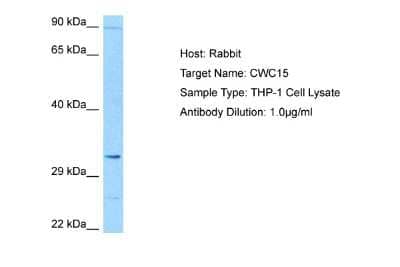 Western Blot: CWC15 Antibody [NBP2-84735] - Host: Rabbit. Target Name: CWC15. Sample Tissue: Human THP-1 Whole Cell lysates. Antibody Dilution: 1ug/ml